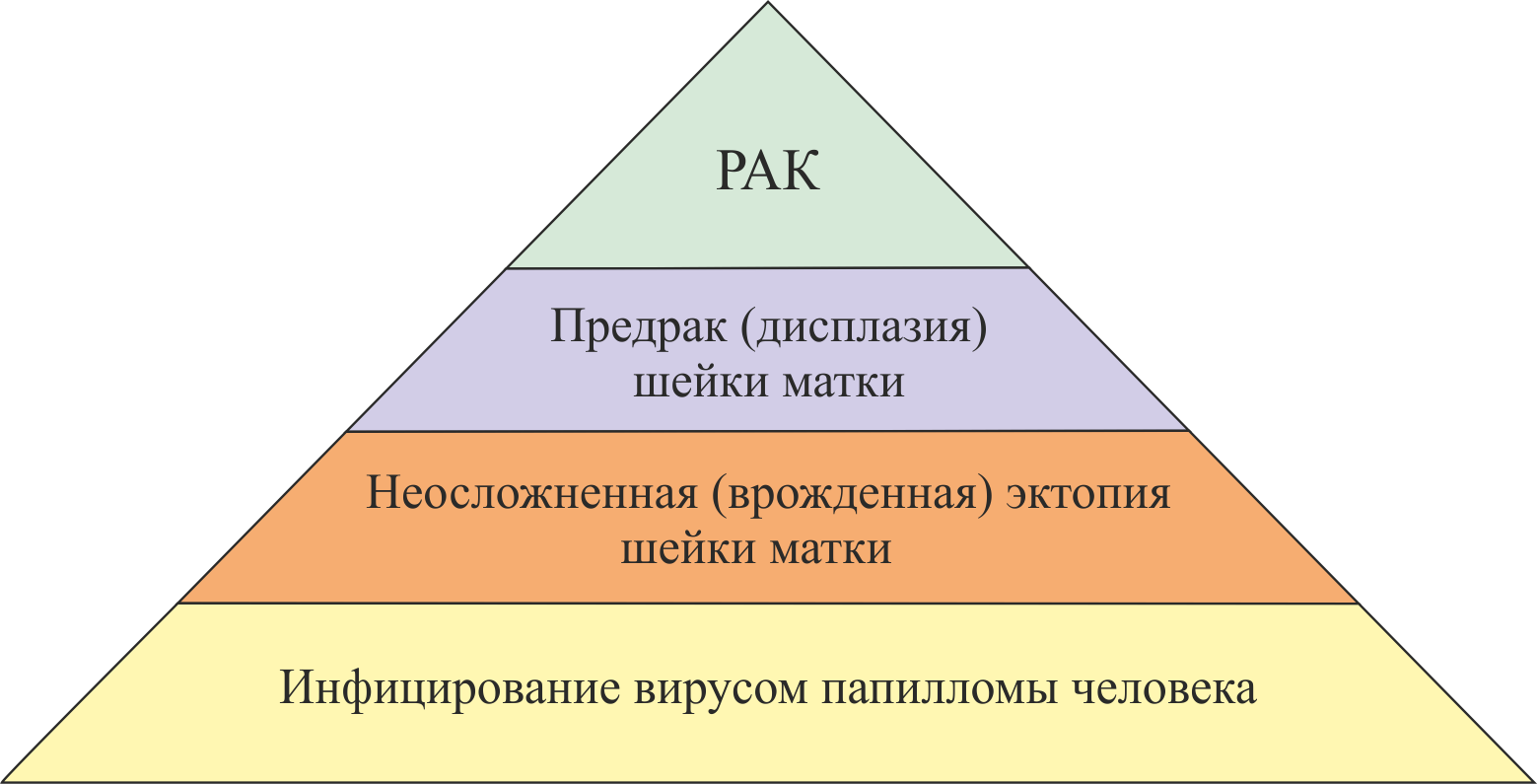 Эктопия, или эрозия шейки матки