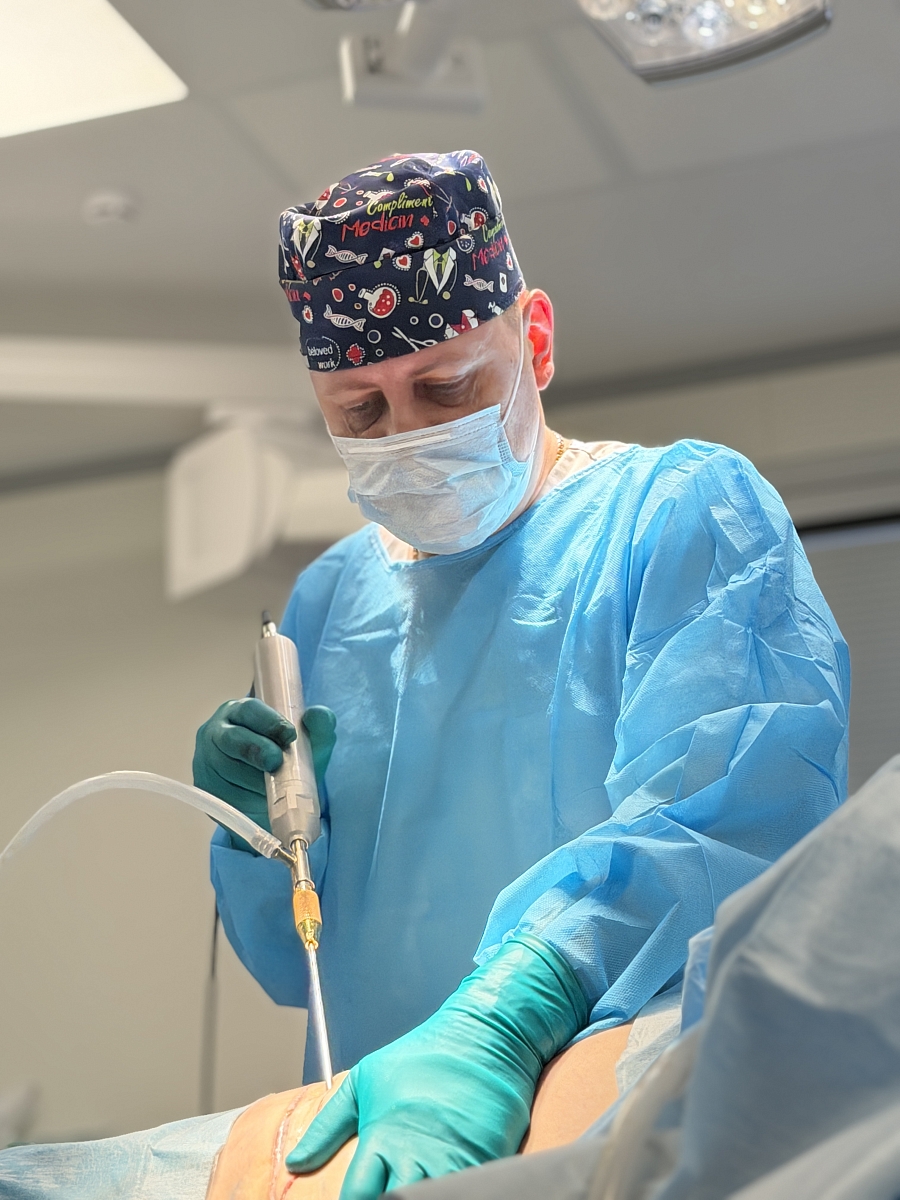 Липосакция